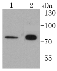 Lane 1: 293T Cell lysates; Lane 2: HeLa cell lysates; probed with Cytokeratin 1 (1C2) Monoclonal Antibody (bsm-52051R) at 1:1000 overnight at 4˚C. Followed by a conjugated secondary antibody.