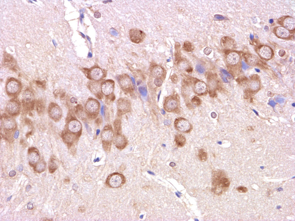 Formalin-fixed and paraffin embedded: rat brain tissue labeled with Anti-beta-Amyloid(1-42) Polyclonal Antibody (bs-0107R), Unconjugated 1:200 followed by conjugation to the secondary antibody and DAB staining