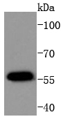 MCF-7 Cell lysates; probed with AKT1(T450) (4A3) Monoclonal Antibody (bsm-52131R) at 1:1000 overnight at 4˚C. Followed by a conjugated secondary antibody.
