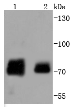 Lane 1: Human skeletal muscle; Lane 2: Hela Cell lysates; probed with Raf1(S259) (2A1 ) Monoclonal Antibody (bsm-52194R) at 1:1000 overnight at 4˚C. Followed by a conjugated secondary antibody.