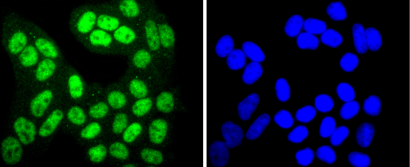 HeLa cells were stained with SIRT1(T530) (6H5) Monoclonal Antibody (bsm-52202R) at [1:200] incubated overnight at 4C, followed by secondary antibody incubation, DAPI staining of the nuclei and detection.