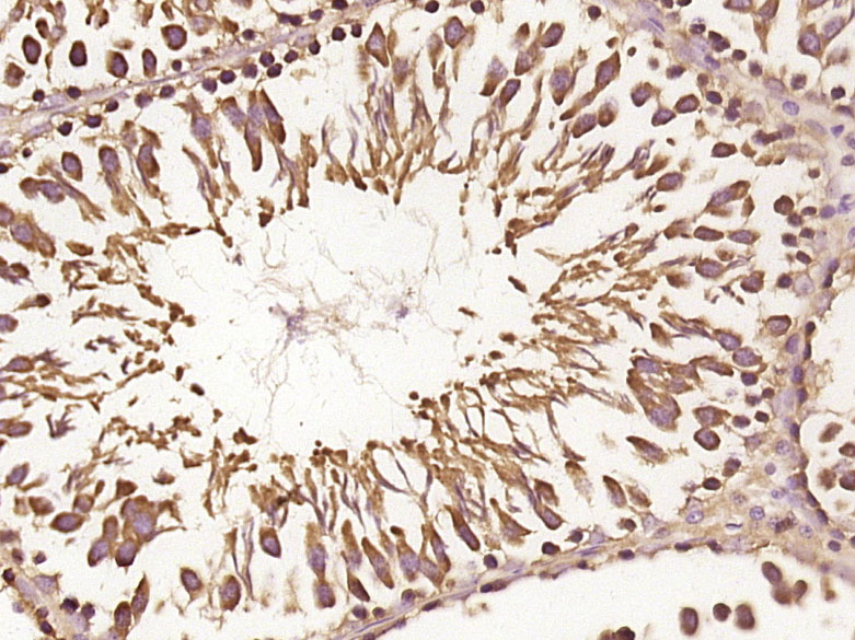 Paraformaldehyde-fixed, paraffin embedded rat testis; Antigen retrieval by boiling in sodium citrate buffer (pH6.0) for 15min; Block endogenous peroxidase by 3% hydrogen peroxide for 20 minutes; Blocking buffer (normal goat serum) at 37°C for 30min; Antibody incubation with RNF170 Polyclonal Antibody (bs-9260R) at 1:400 overnight at 4°C, followed by SP Kit (Rabbit) and DAB.