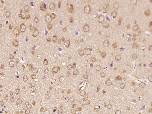 Paraformaldehyde-fixed, paraffin embedded rat brain; Antigen retrieval by boiling in sodium citrate buffer (pH6.0) for 15min; Block endogenous peroxidase by 3% hydrogen peroxide for 20 minutes; Blocking buffer (normal goat serum) at 37°C for 30min; Antibody incubation with RNF170 Polyclonal Antibody (bs-9260R) at 1:400 overnight at 4°C, followed by SP Kit (Rabbit) and DAB.