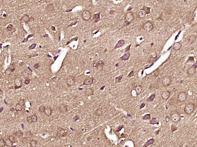 Paraformaldehyde-fixed, paraffin embedded rat brain; Antigen retrieval by boiling in sodium citrate buffer (pH6) for 15min; Block endogenous peroxidase by 3% hydrogen peroxide for 30 minutes; Blocking buffer (normal goat serum) at 37°C for 20min; Antibody incubation with RPS6KB1(Thr 412) Polyclonal Antibody (bs-5669R) at 1:400 overnight at 4°C, followed by a conjugated secondary and DAB staining.