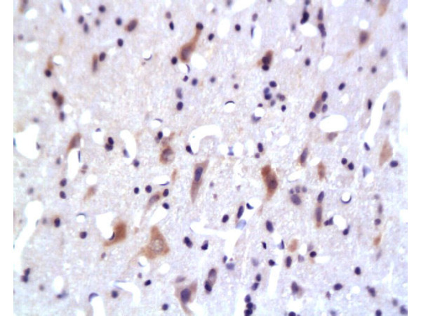 Formalin-fixed and paraffin embedded: rat brain tissue labeled with Anti-PKB Polyclonal Antibody, Unconjugated 1:200 followed by conjugation to the secondary antibody and DAB staining