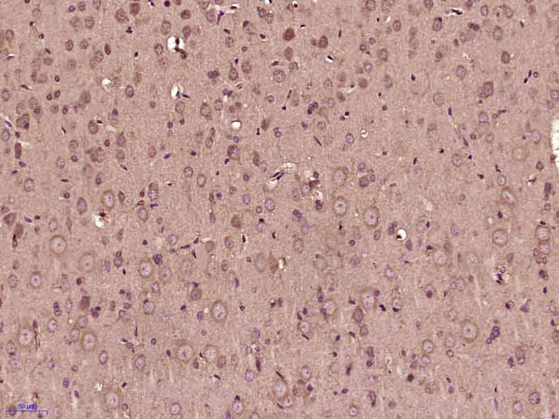 Paraformaldehyde-fixed, paraffin embedded rat brain; Antigen retrieval by boiling in sodium citrate buffer (pH6) for 15min; Block endogenous peroxidase by 3% hydrogen peroxide for 30 minutes; Blocking buffer (normal goat serum) at 37°C for 20min; Antibody incubation with RPS6KA1(Thr348) Polyclonal Antibody (bs-5680R) at 1:400 overnight at 4°C, followed by a conjugated secondary and DAB staining.
