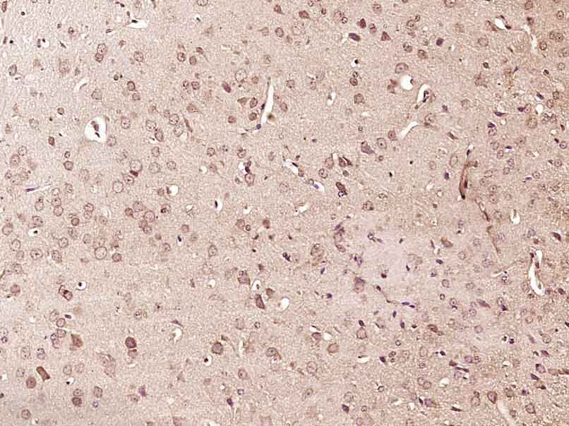 Paraformaldehyde-fixed, paraffin embedded rat brain; Antigen retrieval by boiling in sodium citrate buffer (pH6) for 15min; Block endogenous peroxidase by 3% hydrogen peroxide for 30 minutes; Blocking buffer (normal goat serum) at 37°C for 20min; Antibody incubation with RPS6KA1(Thr348) Polyclonal Antibody (bs-5680R) at 1:400 overnight at 4°C, followed by a conjugated secondary and DAB staining.
