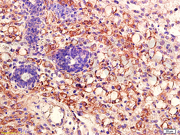 Formalin-fixed and paraffin embedded: mouse transplant lymphoma labeled with Anti-PKB Polyclonal Antibody, Unconjugated 1:200 followed by conjugation to the secondary antibody and DAB staining