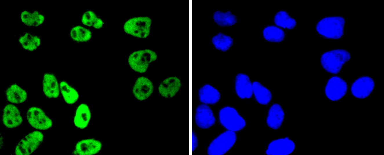 HeLa cells were stained with MSK1 (Ser376) (11A1) Monoclonal Antibody (bsm-52123R) at [1:200] incubated overnight at 4C, followed by secondary antibody incubation, DAPI staining of the nuclei and detection.