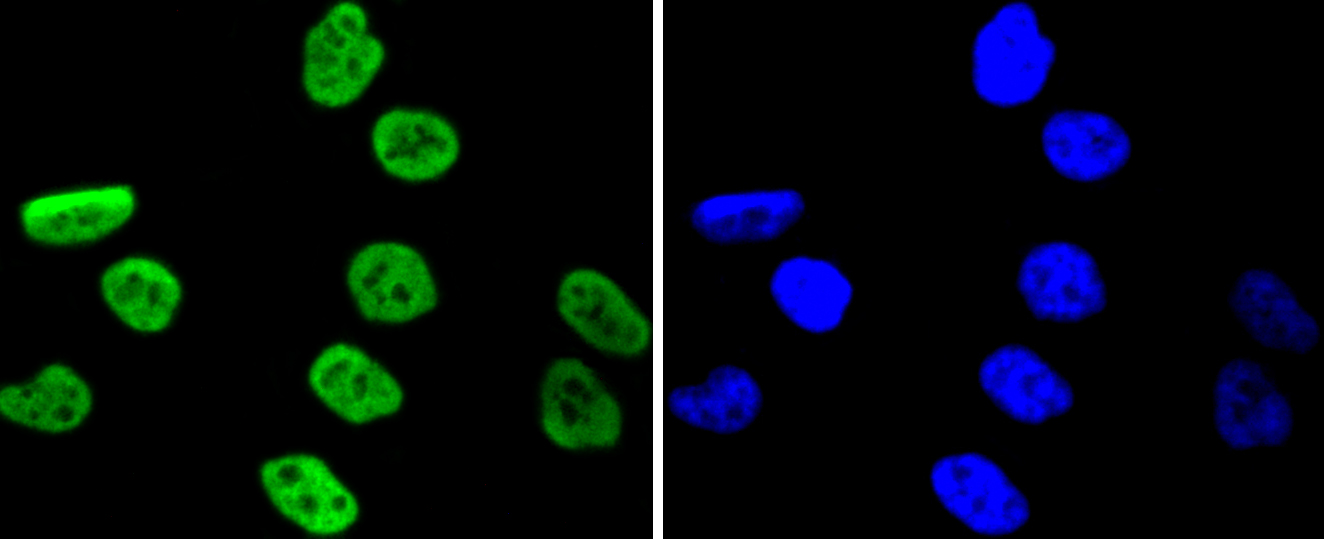 PC-3 cells were stained with MSK1 (Ser376) (11A1) Monoclonal Antibody (bsm-52123R) at [1:200] incubated overnight at 4C, followed by secondary antibody incubation, DAPI staining of the nuclei and detection.