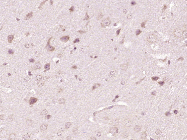 Paraformaldehyde-fixed, paraffin embedded mouse brain; Antigen retrieval by boiling in sodium citrate buffer (pH6) for 15min; Block endogenous peroxidase by 3% hydrogen peroxide for 30 minutes; Blocking buffer (normal goat serum) at 37°C for 20min; Antibody incubation with ATP7A Polyclonal Antibody, Unconjugated (bs-1572R) at 1:400 overnight at 4°C, followed by a conjugated secondary and DAB staining.