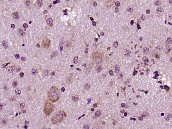 Paraformaldehyde-fixed, paraffin embedded rat brain; Antigen retrieval by boiling in sodium citrate buffer (pH6) for 15min; Block endogenous peroxidase by 3% hydrogen peroxide for 30 minutes; Blocking buffer (normal goat serum) at 37°C for 20min; Antibody incubation with FADD Polyclonal Antibody (bs-0511R) at 1:400 overnight at 4°C, followed by a conjugated secondary and DAB staining. Paraformaldehyde-fixed, paraffin embedded rat brain; Antigen retrieval by boiling in sodium citrate buffer (pH6) for 15min; Block endogenous peroxidase by 3% hydrogen peroxide for 30 minutes; Blocking buffer (normal goat serum) at 37°C for 20min; Antibody incubation with FADD Polyclonal Antibody (bs-0511R) at 1:400 overnight at 4°C, followed by a conjugated secondary and DAB staining.