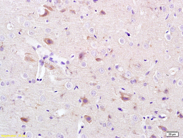 Formalin-fixed and paraffin embedded rat brain labeled with Anti-CACNA1G/Cav3.1 Polyclonal Antibody, Unconjugated (bs-2781R) at 1:200 followed by conjugation to the secondary antibody and DAB staining.