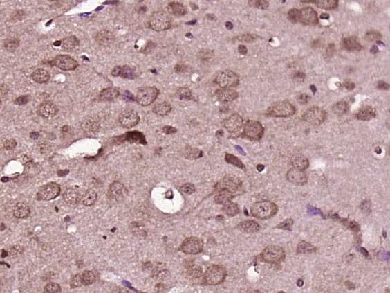 Paraformaldehyde-fixed, paraffin embedded Mouse brain; Antigen retrieval by boiling in sodium citrate buffer (pH6.0) for 15min; Block endogenous peroxidase by 3% hydrogen peroxide for 20 minutes; Blocking buffer (normal goat serum) at 37°C for 30min; Antibody incubation with Axin 2 Polyclonal Antibody, Unconjugated (bs-5717R) at 1:400 overnight at 4°C, DAB staining.