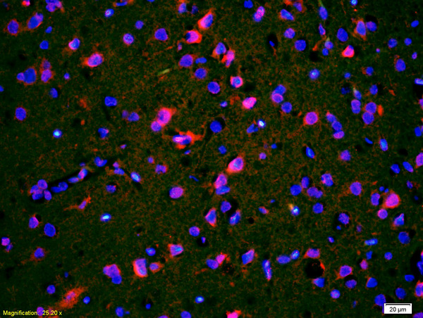 Formalin-fixed and paraffin-embedded rat brain labeled with Anti-CACNA1G/Cav3.1 Polyclonal Antibody, Unconjugated(bs-2781R) 1:200, overnight at 4°C, The secondary antibody was Goat Anti-Rabbit IgG, Cy3 conjugated(bs-0295G-Cy3)used at 1:200 dilution for 40 minutes at 37°C.