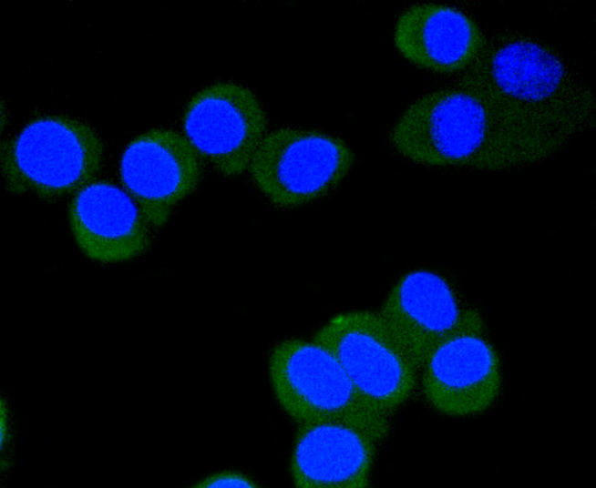 SH-SY-5Y cells were fixed in paraformaldehyde, permeabilized with 0.25% Triton X100/PBS and stained with eIF4E(S209) (2B1 ) Monoclonal Antibody (bsm-52152R) at 1:200 and incubated overnight at 4C, followed by secondary antibody incubation, DAPI staining of the nuclei and detection.