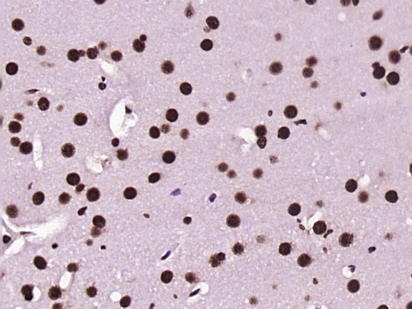 Paraformaldehyde-fixed, paraffin embedded mouse brain; Antigen retrieval by boiling in sodium citrate buffer (pH6) for 15min; Block endogenous peroxidase by 3% hydrogen peroxide for 30 minutes; Blocking buffer (normal goat serum) at 37°C for 20min; Antibody incubation with KLHL7 Polyclonal Antibody (bs-5935R) at 1:400 overnight at 4°C, followed by a conjugated secondary and DAB staining.