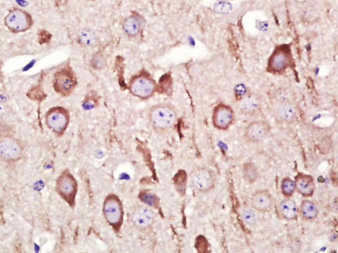 Paraformaldehyde-fixed, paraffin embedded mouse brain; Antigen retrieval by boiling in sodium citrate buffer (pH6) for 15min; Block endogenous peroxidase by 3% hydrogen peroxide for 30 minutes; Blocking buffer (normal goat serum) at 37°C for 20min; Antibody incubation with GADD45B Polyclonal Antibody (bs-5904R) at 1:400 overnight at 4°C, followed by a conjugated secondary and DAB staining.