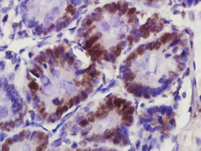Paraformaldehyde-fixed, paraffin embedded rat colon; Antigen retrieval by boiling in sodium citrate buffer (pH6) for 15min; Block endogenous peroxidase by 3% hydrogen peroxide for 30 minutes; Blocking buffer (normal goat serum) at 37°C for 20min; Antibody incubation with KLK6 Polyclonal Antibody (bs-5870R) at 1:400 overnight at 4°C, followed by a conjugated secondary and DAB staining.
