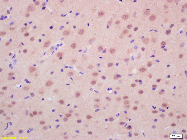 Formalin-fixed and paraffin embedded rat brain labeled with Anti-RASSF2 Polyclonal Antibody, Unconjugated (bs-2939R) at 1:200 followed by conjugation to the secondary antibody and DAB staining.