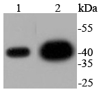 Lane 1: HeLa Cell lysates; Lane 2: PC-12 Cell lysates; Lane 3: CRC lysates; probed with ERK2 (3G1) Monoclonal Antibody (bsm-52068R) at 1:1000 overnight at 4˚C. Followed by a conjugated secondary antibody.