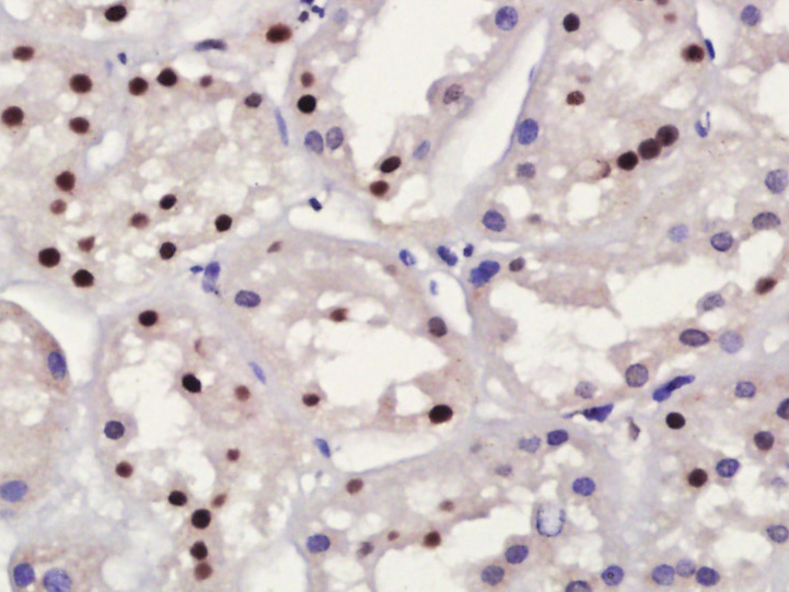 Paraformaldehyde-fixed, paraffin embedded (Human kidney); Antigen retrieval by boiling in sodium citrate buffer (pH6.0) for 15min; Block endogenous peroxidase by 3% hydrogen peroxide for 20 minutes; Blocking buffer (normal goat serum) at 37°C for 30min; Antibody incubation with (RNF56) Polyclonal Antibody, Unconjugated (bs-5949R) at 1:400 overnight at 4°C, followed by operating according to SP Kit(Rabbit) (sp-0023) instructionsand DAB staining.