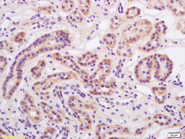 Formalin-fixed and paraffin embedded rat kidney labeled with Anti-Alpha-ENaC Polyclonal Antibody, Unconjugated (bs-2957R) at 1:200 followed by conjugation to the secondary antibody and DAB staining.