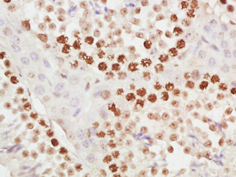 Paraformaldehyde-fixed, paraffin embedded mouse testis; Antigen retrieval by boiling in sodium citrate buffer (pH6) for 15min; Block endogenous peroxidase by 3% hydrogen peroxide for 30 minutes; Blocking buffer (normal goat serum) at 37°C for 20min; Antibody incubation with METTL11A Polyclonal Antibody (bs-6057R) at 1:400 overnight at 4°C, followed by a conjugated secondary and DAB staining.
