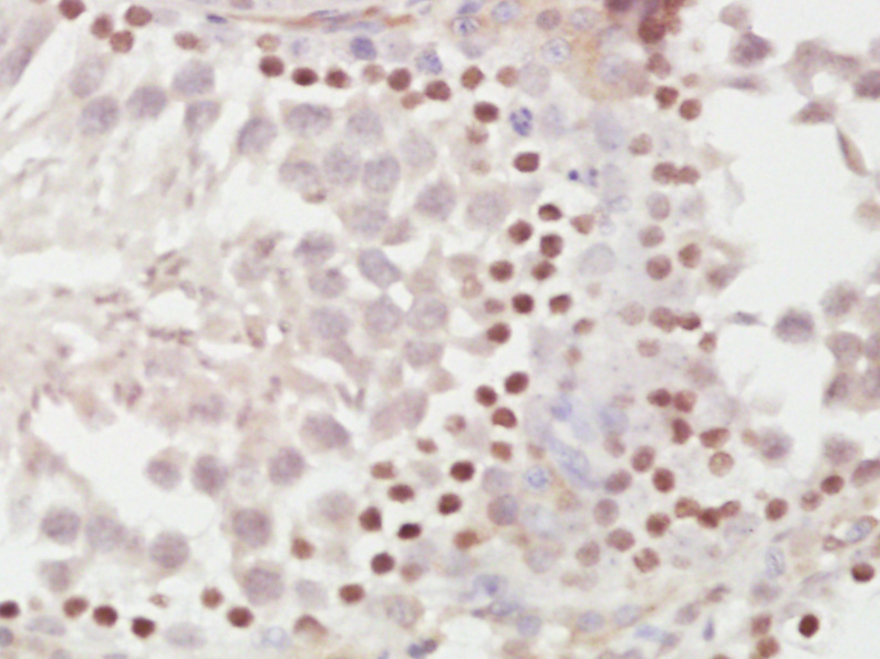 Paraformaldehyde-fixed, paraffin embedded rat testis; Antigen retrieval by boiling in sodium citrate buffer (pH6) for 15min; Block endogenous peroxidase by 3% hydrogen peroxide for 30 minutes; Blocking buffer (normal goat serum) at 37°C for 20min; Antibody incubation with METTL11A Polyclonal Antibody (bs-6057R) at 1:400 overnight at 4°C, followed by a conjugated secondary and DAB staining Paraformaldehyde-fixed, paraffin embedded rat testis; Antigen retrieval by boiling in sodium citrate buffer (pH6) for 15min; Block endogenous peroxidase by 3% hydrogen peroxide for 30 minutes; Blocking buffer (normal goat serum) at 37°C for 20min; Antibody incubation with METTL11A Polyclonal Antibody (bs-6057R) at 1:400 overnight at 4°C, followed by a conjugated secondary and DAB staining