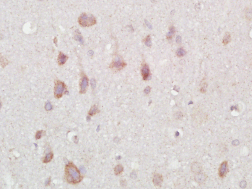Paraformaldehyde-fixed, paraffin embedded rat brain; Antigen retrieval by boiling in sodium citrate buffer (pH6) for 15min; Block endogenous peroxidase by 3% hydrogen peroxide for 30 minutes; Blocking buffer (normal goat serum) at 37°C for 20min; Antibody incubation with NARC1 Polyclonal Antibody (bs-6060R) at 1:400 overnight at 4°C, followed by a SP kit and DAB staining.