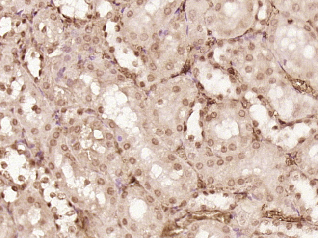 Paraformaldehyde-fixed, paraffin embedded rat kidney; Antigen retrieval by boiling in sodium citrate buffer (pH6) for 15min; Block endogenous peroxidase by 3% hydrogen peroxide for 30 minutes; Blocking buffer (normal goat serum) at 37°C for 20min; Antibody incubation with _x000D_ PRMT6 Polyclonal Antibody (bs-6063R) at 1:200 overnight at 4°C, followed by a conjugated secondary and DAB staining.