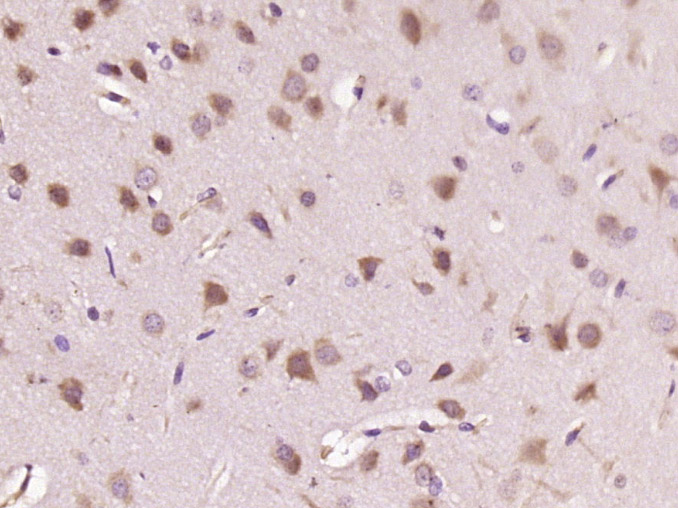 Paraformaldehyde-fixed, paraffin embedded rat brain; Antigen retrieval by boiling in sodium citrate buffer (pH6) for 15min; Block endogenous peroxidase by 3% hydrogen peroxide for 30 minutes; Blocking buffer (normal goat serum) at 37°C for 20min; Antibody incubation with HDPTP Polyclonal Antibody (bs-15434R) at 1:400 overnight at 4°C, followed by a SP kit and DAB staining.