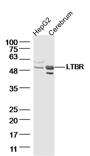 Lane 1: HepG2, Lane 2: Mouse cerebrum lysates probed with LTBR Polyclonal Antibody (bs-6917R) at 1:300 overnight at 4˚C. Followed by a conjugated secondary antibody at 1:5000 for 90 min at 37˚C.