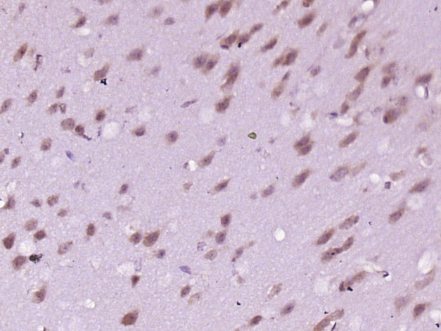 Paraformaldehyde-fixed, paraffin embedded mouse brain; Antigen retrieval by boiling in sodium citrate buffer (pH6) for 15min; Block endogenous peroxidase by 3% hydrogen peroxide for 30 minutes; Blocking buffer (normal goat serum) at 37°C for 20min; Antibody incubation with INPPL1(Tyr1135) Polyclonal Antibody (bs-3399R) at 1:400 overnight at 4°C, followed by a conjugated secondary and DAB staining.