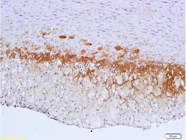 Formalin-fixed and paraffin embedded: rabbit carotid artery labeled with Anti-TGF-beta-R2\/TGFBR2 Polyclonal Antibody (bs-0117R), Unconjugated 1:600 followed by conjugation to the secondary antibody and DAB staining