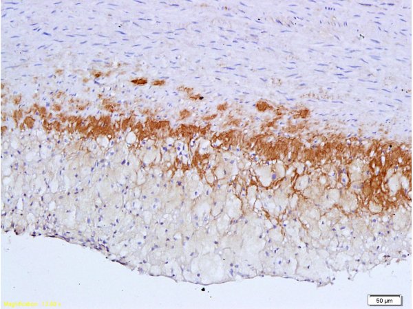 Formalin-fixed and paraffin embedded: rabbit carotid artery labeled with Anti-TGF-beta-R2/TGFBR2 Polyclonal Antibody (bs-0117R), Unconjugated 1:600 followed by conjugation to the secondary antibody and DAB staining