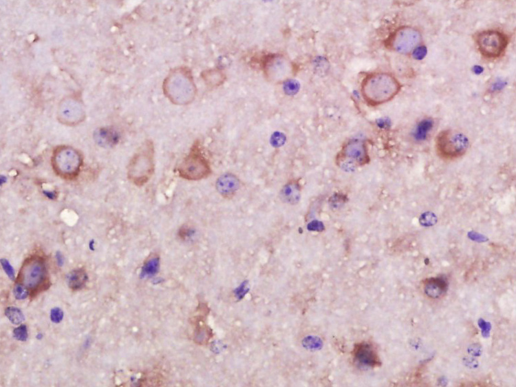 Paraformaldehyde-fixed, paraffin embedded mouse brain; Antigen retrieval by boiling in sodium citrate buffer (pH6) for 15min; Block endogenous peroxidase by 3% hydrogen peroxide for 30 minutes; Blocking buffer (normal goat serum) at 37°C for 20min; Antibody incubation with INPPL1 Polyclonal Antibody (bs-7048R) at 1:400 overnight at 4°C, followed by a conjugated secondary and DAB staining.