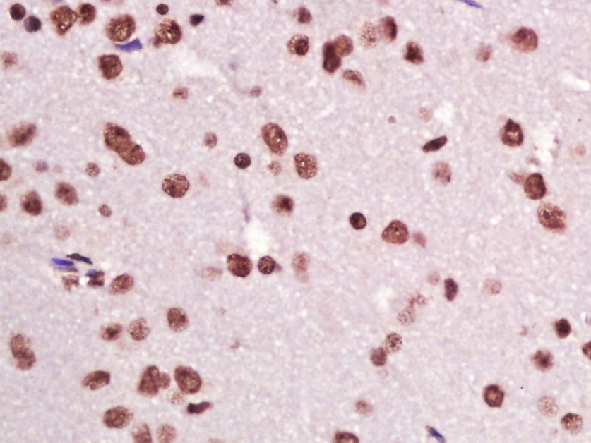 Paraformaldehyde-fixed, paraffin embedded rat brain; Antigen retrieval by boiling in sodium citrate buffer (pH6) for 15min; Block endogenous peroxidase by 3% hydrogen peroxide for 30 minutes; Blocking buffer (normal goat serum) at 37°C for 20min; Antibody incubation with CIDEC Polyclonal Antibody (bs-6796R) at 1:400 overnight at 4°C, followed by a conjugated secondary and DAB staining.