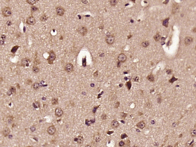 Paraformaldehyde-fixed, paraffin embedded mouse brain; Antigen retrieval by boiling in sodium citrate buffer (pH6) for 15min; Block endogenous peroxidase by 3% hydrogen peroxide for 30 minutes; Blocking buffer (normal goat serum) at 37°C for 20min; Antibody incubation with ELOVL2 Polyclonal Antibody (bs-7053R) at 1:400 overnight at 4°C, followed by a conjugated secondary and DAB staining.