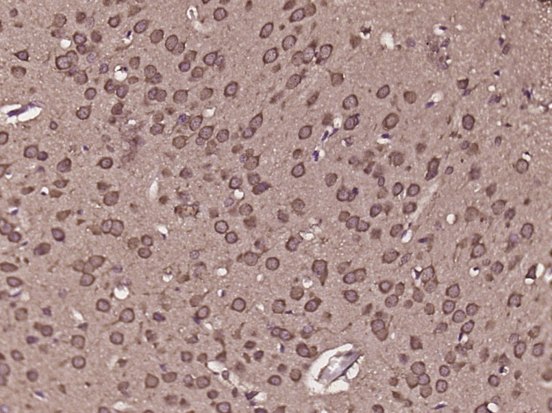 Paraformaldehyde-fixed, paraffin embedded rat brain; Antigen retrieval by boiling in sodium citrate buffer (pH6) for 15min; Block endogenous peroxidase by 3% hydrogen peroxide for 30 minutes; Blocking buffer (normal goat serum) at 37°C for 20min; Antibody incubation with c8orf84 Polyclonal Antibody (bs-15304R) at 1:400 overnight at 4°C, followed by a conjugated secondary and DAB staining.