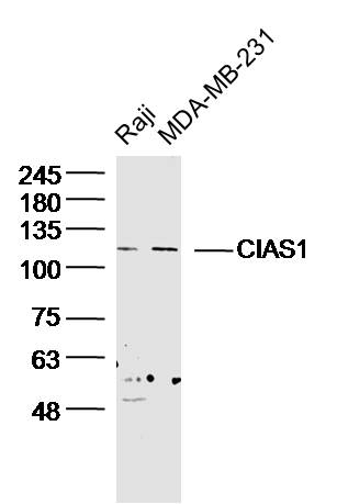 Lane 1: Raji lysates; Lane 2: MDA-MB-231 probed with Cryopyrin Polyclonal Antibody (bs-10021R) at 1:300 overnight at 4˚C. Followed by conjugation to secondary antibody (bs-0295G-HRP) at 1:5000 for 90 min at 37˚C.