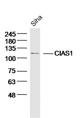 SiHa lysates probed with Rabbit Anti-Cryopyrin Polyclonal Antibody, Unconjugated (bs-10021R) at 1:300 overnight at 4˚C. Followed by conjugation to secondary antibody (bs-0295G-HRP) at 1:5000 for 90 min at 37˚C.
