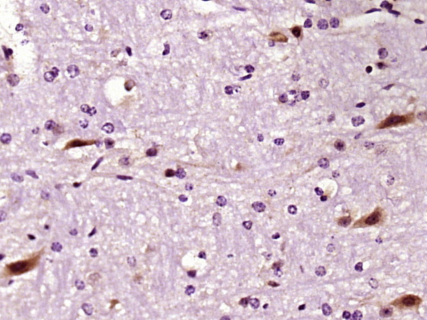 Paraformaldehyde-fixed, paraffin embedded mouse brain; Antigen retrieval by boiling in sodium citrate buffer (pH6) for 15min; Block endogenous peroxidase by 3% hydrogen peroxide for 30 minutes; Blocking buffer (normal goat serum) at 37°C for 20min; Antibody incubation with LIMK1 Polyclonal Antibody (bs-2775R) at 1:400 overnight at 4°C, followed by a conjugated secondary and DAB staining.