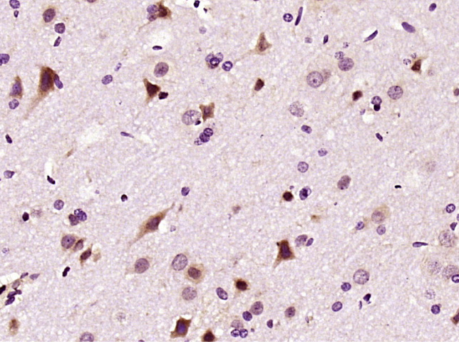 Paraformaldehyde-fixed, paraffin embedded rat brain; Antigen retrieval by boiling in sodium citrate buffer (pH6) for 15min; Block endogenous peroxidase by 3% hydrogen peroxide for 30 minutes; Blocking buffer (normal goat serum) at 37°C for 20min; Antibody incubation with LIMK1 Polyclonal Antibody (bs-2775R) at 1:400 overnight at 4°C, followed by a conjugated secondary and DAB staining.