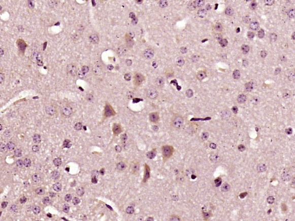Paraformaldehyde-fixed, paraffin embedded mouse tissue; Antigen retrieval by boiling in sodium citrate buffer (pH6) for 15min; Block endogenous peroxidase by 3% hydrogen peroxide for 30 minutes; Blocking buffer (normal goat serum) at 37°C for 20min; Antibody incubation with IL-22 Polyclonal Antibody (bs-2623R) at 1:400 overnight at 4°C, followed by a conjugated secondary and DAB staining.