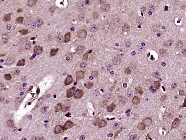 Paraformaldehyde-fixed, paraffin embedded mouse brain; Antigen retrieval by boiling in sodium citrate buffer (pH6) for 15min; Block endogenous peroxidase by 3% hydrogen peroxide for 30 minutes; Blocking buffer (normal goat serum) at 37°C for 20min; Antibody incubation with Versican Polyclonal Antibody (bs-2533R) at 1:400 overnight at 4°C, followed by a conjugated secondary and DAB staining.