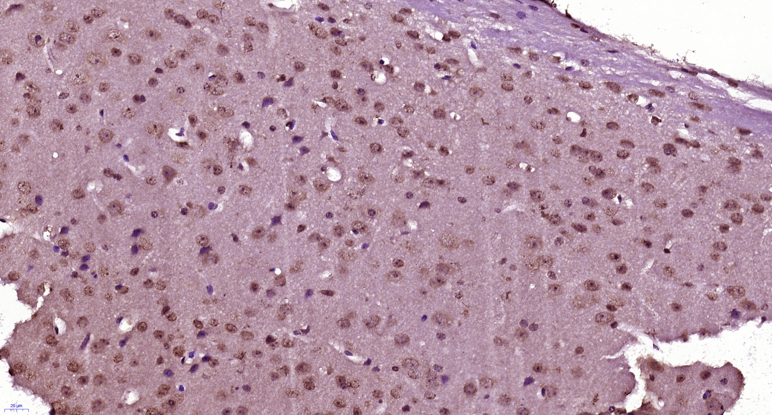 Paraformaldehyde-fixed, paraffin embedded (Mouse brain); Antigen retrieval by boiling in sodium citrate buffer (pH6.0) for 15min; Block endogenous peroxidase by 3% hydrogen peroxide for 20 minutes; Blocking buffer (normal goat serum) at 37°C for 30min; Antibody incubation with SRRM4 Polyclonal Antibody, Unconjugated (bs-8069R) at 1:400 overnight at 4°C, followed by a conjugated secondary and DAB staining.