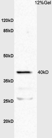 L1 mouse intestine lysates probed with Anti TNFR1/TNF Receptor I Polyclonal Antibody, Unconjugated (bs-2941R) at 1:200 overnight at 4˚C. Followed by conjugation to secondary antibody (bs-0295G-HRP) at 1:3000 for 90 min at 37˚C. Predicted band 40kD/26kD. Observed band size:40kD/26kD.\n
