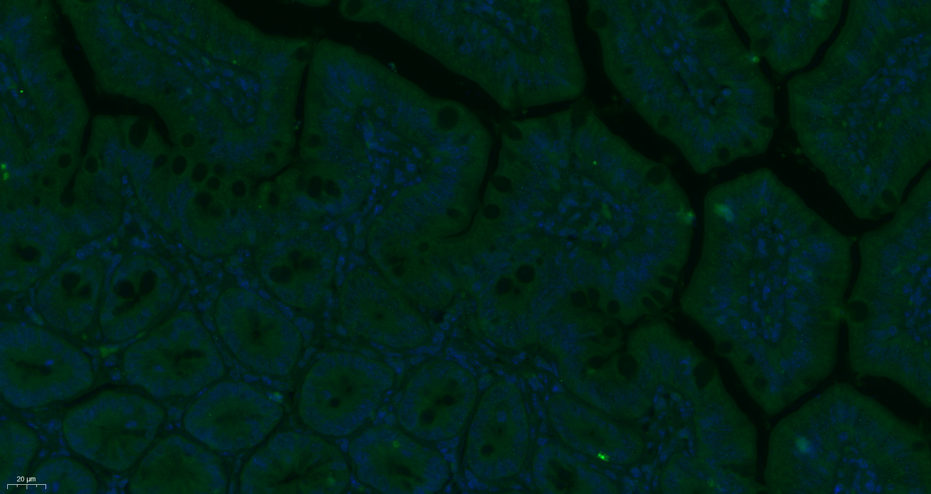 Paraformaldehyde-fixed, paraffin embedded Mouse small intestine; Antigen retrieval by boiling in sodium citrate buffer (pH6.0) for 15min; Block endogenous peroxidase by 3% hydrogen peroxide for 20 minutes; Blocking buffer (normal goat serum) at 37°C for 30min; Antibody incubation with TEM1/CD248 Polyclonal Antibody, Unconjugated (bs-2101R) at 1:400 overnight at 4°C, followed by a FITC conjugated secondary antibody for 90 minutes, and DAPI for nuclei staining.