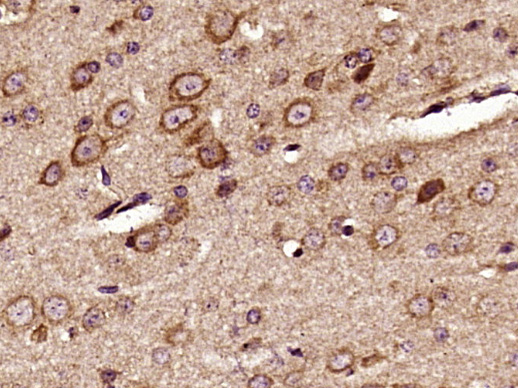 Paraformaldehyde-fixed, paraffin embedded mouse brain; Antigen retrieval by boiling in sodium citrate buffer (pH6) for 15min; Block endogenous peroxidase by 3% hydrogen peroxide for 30 minutes; Blocking buffer (normal goat serum) at 37°C for 20min; Antibody incubation with _x000D_ Pyk2 (Tyr402) Polyclonal Antibody (bs-3400R) at 1:400 overnight at 4°C, followed by a conjugated secondary and DAB staining.